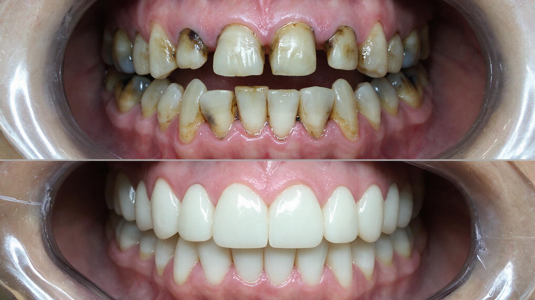 Estética Dental